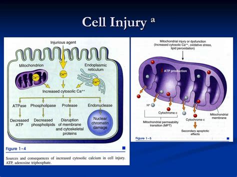 Ppt Cell Injury And Inflammation Powerpoint Presentation Free