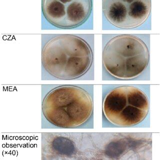 Macroscopic And Microscopic Characteristics Of Emericella Nidulans