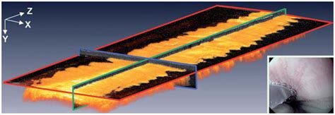Volumetric Rendering Of D Oct Data From The Normal Mid Esophagus