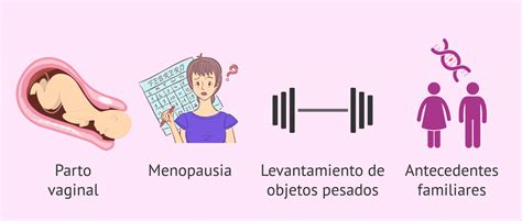 Qu Es El Prolapso Uterino Causas S Ntomas Y Tratamiento