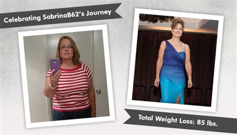 Pin on Before & After Bariatric Surgery - Inspiration