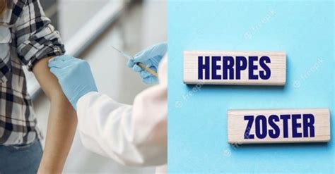 Vaksin Herpes Zoster Penjelasan Umum Efektivitas Efek Samping