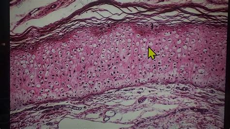 HISTOLOGIA Dr Moya CARTILAGO Laminas Histologicas YouTube