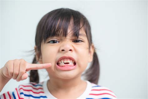 Gigi Susu Anak Berlubang Harus Ditambal Atau Tunggu Ganti