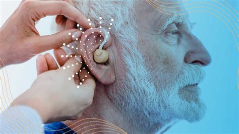 Does Insurance Cover Hearing Aids