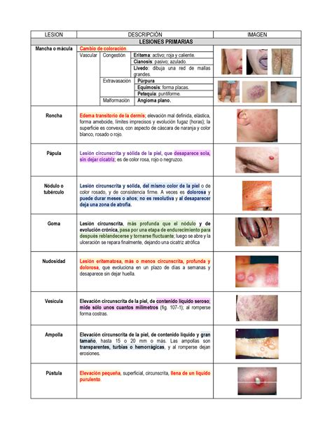 Lesiones primarias y secundarias LESION DESCRIPCIÓN IMAGEN LESIONES