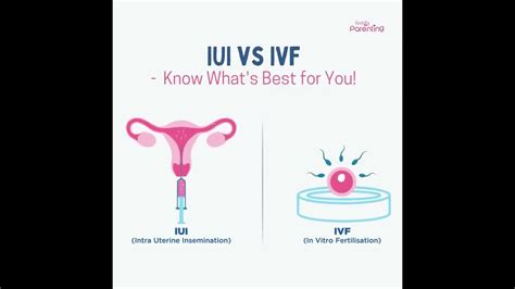 Ivf Vs Iui Know The Difference Youtube