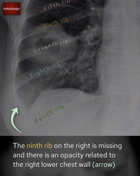 Theradiologist On Twitter Case Explanation