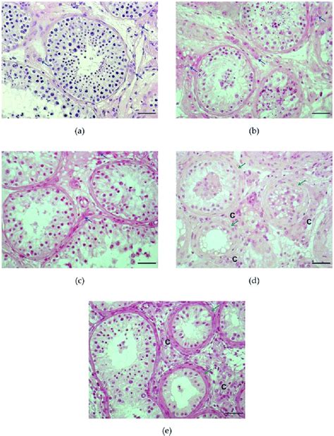 Microphotographs Of Testicular Histology A Section Of Testicular