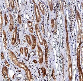 Erythropoietin Epo Antibody Unconjugated Ab Na Novus Biologicals