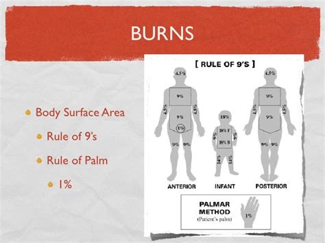 Fca 0712 Burns