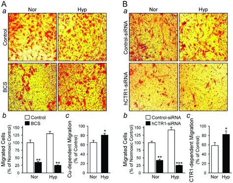 PASMC Migration Is Dependent On Cu And Inhibited By Knockdown Of CTR1