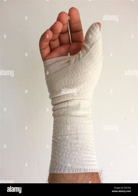 Bandaged hand and arm Stock Photo - Alamy