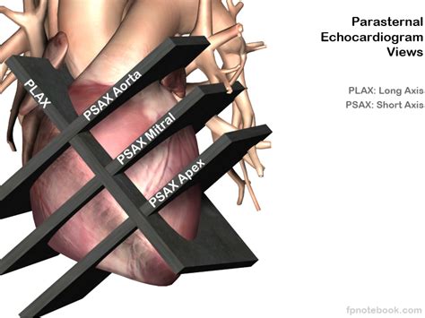 Parasternal Long Axis Echocardiogram View