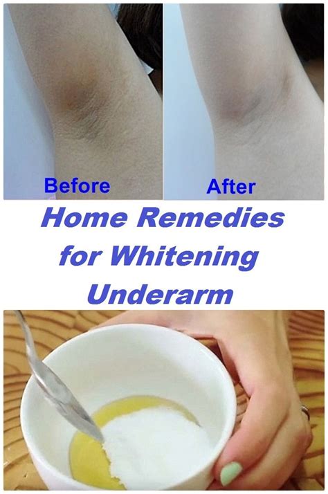 Home Remedy For Chicken Skin Underarm