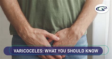 Varicoceles What You Should Know Urology Hospital