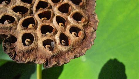 Skin Diseases Holes