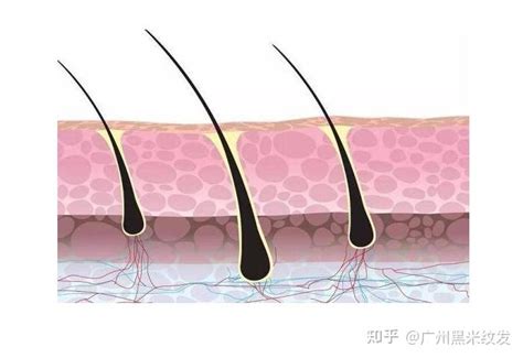 黑米3d纹发：从脱发到毛囊闭合的路，要走几步了？ 知乎