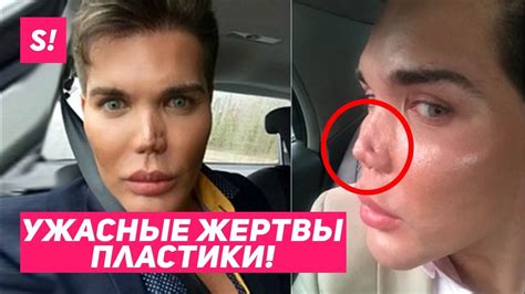 САМЫЕ ЖУТКИЕ ЖЕРТВЫ ПЛАСТИКИ / ЖИВЫЕ "КЕНЫ" 😨😱 - YouTube