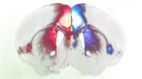 Disentangling Multiple System Atrophy Structural Insights From Alpha