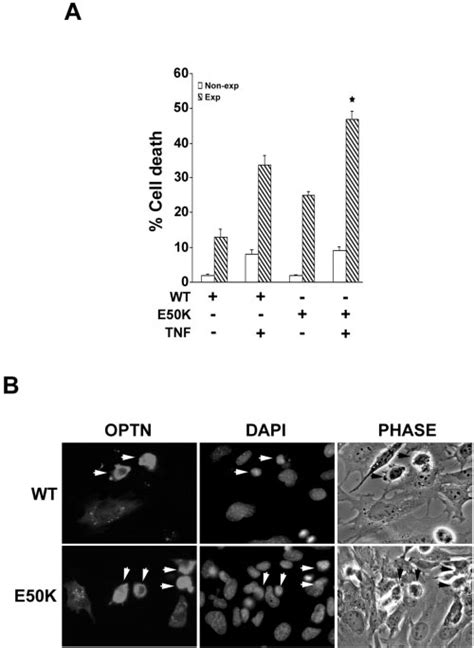 A Effect Of Wt And E50k Mutant Optineurin On Tnf Induced Killing Of