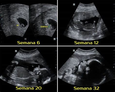 ¿cómo Son Las Ecografías Durante El Embarazo Semana A Semana Mibbmemima ️