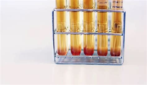 Microbiology Analysis E Coli In Food Sample Use Most Probable Number