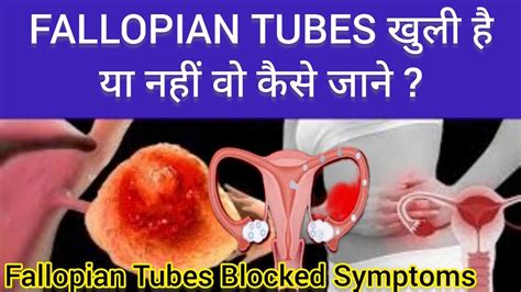 Fallopian Tube Band Hone Ke Lakshan Fallopian Tube Blockage Symptoms Youtube