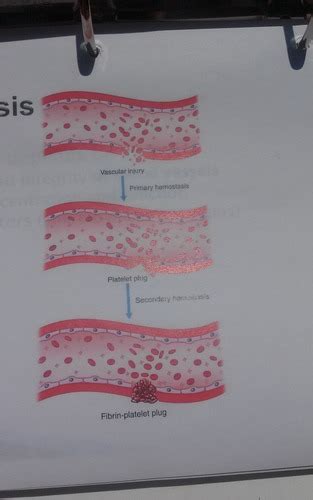 Unit 5 Platelets And Hemostasis Flashcards Quizlet