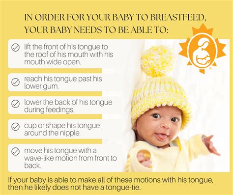 Tongue And Lip Ties La Leche League Canada Breastfeeding Support