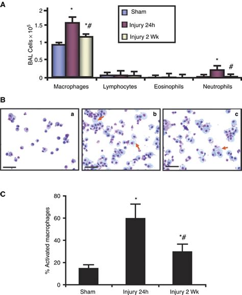 Analysis Of The Inflammatory Cells In Balf After Brain Injury A