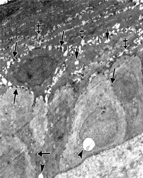 A Photomicrograph Of The Rat Cornea Of Group Iv Showing Preserved