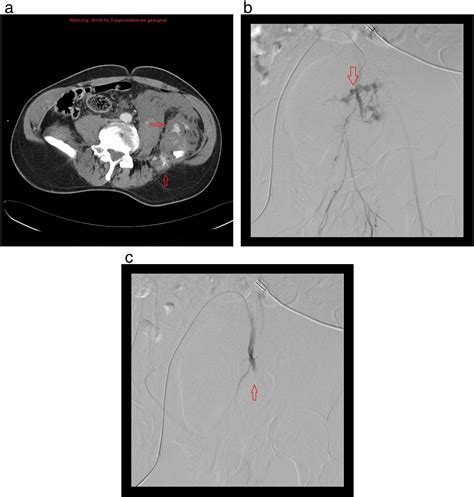 Multidetector Computed Tomography MDCT Simple CT Protocol For Trauma