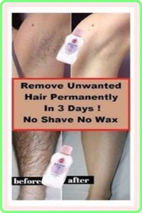 Remove Unwanted Hair Permanently In Three Days No Shave No Wax Artofit