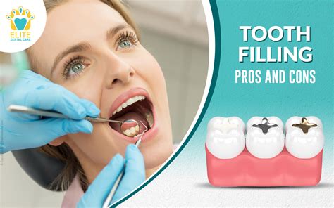 What are the Pros and Cons of Undergoing Dental Tooth Filling? | Elite ...