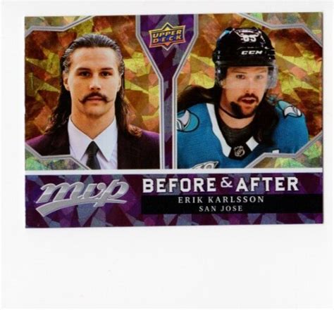 2021 22 Upper Deck MVP Erik Karlsson BA 6 Gold Before After San Jose