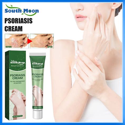 South Moon Psoriasis Cream Anti Itching Psoriasis Cream Antibacterial Treatment Eczema Red Rash