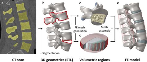 Construction Of The Finite Element Model Of The Intact Lumbar Spine