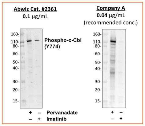 Phospho C Cbl Y774 Recombinant MAb Abwiz Bio