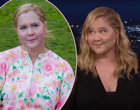 Amy Schumer Says Negative Comments About Her Puffier Face Led To