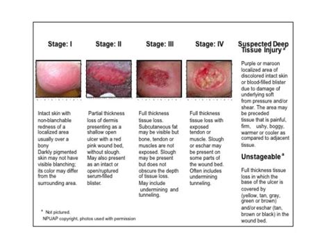 Pp skin and wound care