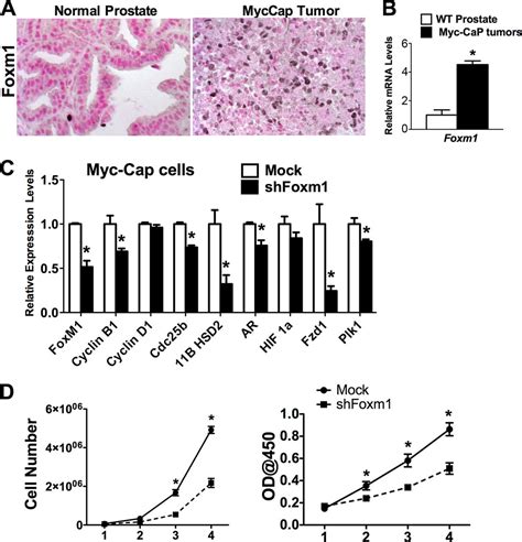 Foxm1 Expression In Prostate Epithelial Cells Is Essential For Prostate