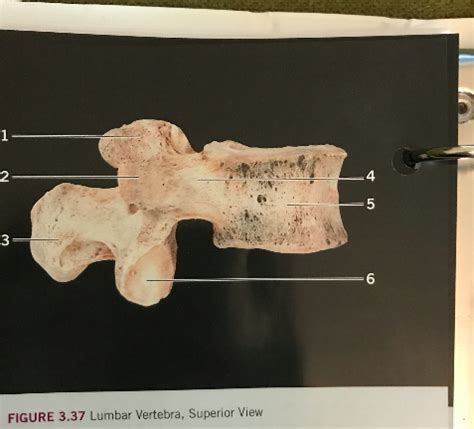 Lumbar Vertebra Lateral View Diagram Quizlet