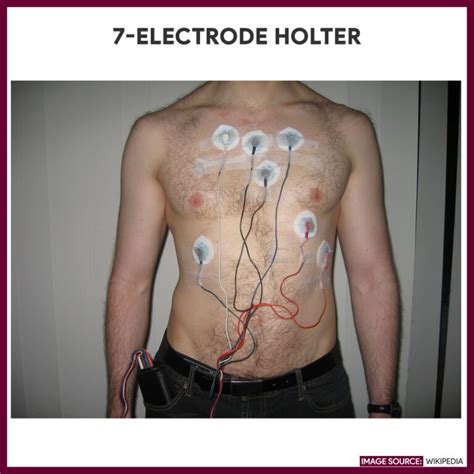 Holter Monitoring Nursing Responsibilities And Care Plan Nurseslabs