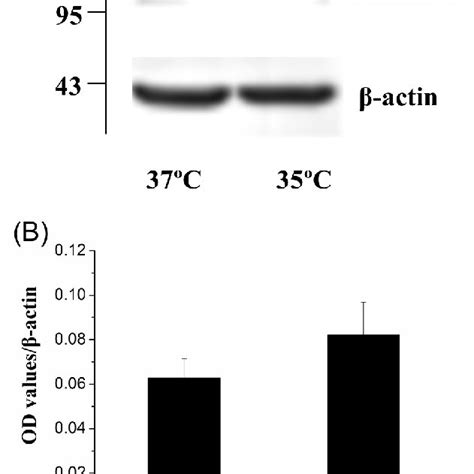 Effect Of Mild Hypothermia On The Expression Of Icam On Eahy