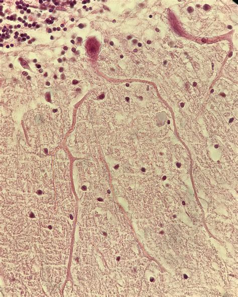 Célula De Purkinje Histología Y Embriología