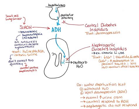 MD in training — SIADH and Central vs Nephrogenic DI