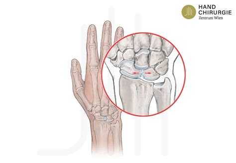 Bewegungen Des Handgelenks