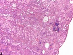 Kidney Nephropathy Chronic Progressive Nonneoplastic Lesion Atlas