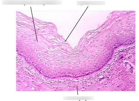 Stratified Squamous Epithelium Vagina Diagram Quizlet